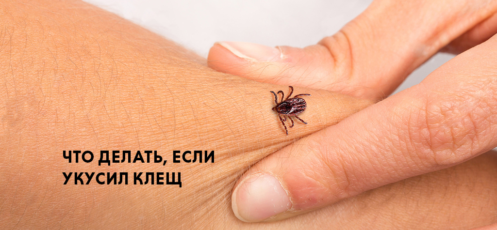 Что делать, если укусил клещ Что делать, если укусил клещ